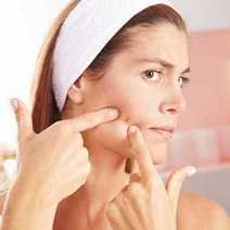 A woman pinching a pimple