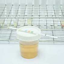 A pregnancy test or urine test