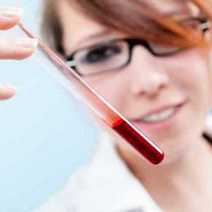  A woman working with blood in  a test-tube